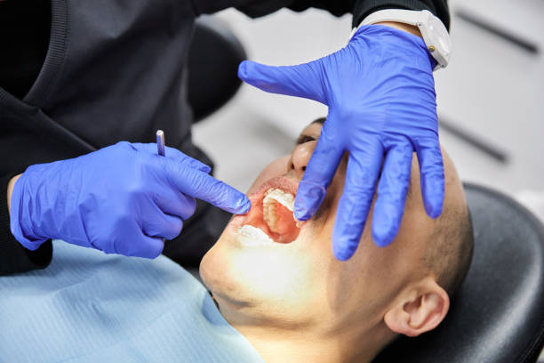 Best Emergency Dental Surgery in Mchenry, IL